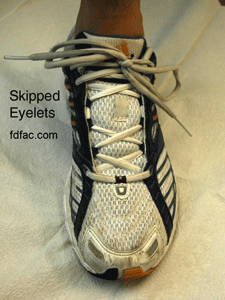 skipped_eyelets-copy1.gif