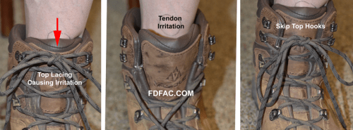 Hiking_Boot_Hook_Irritation
